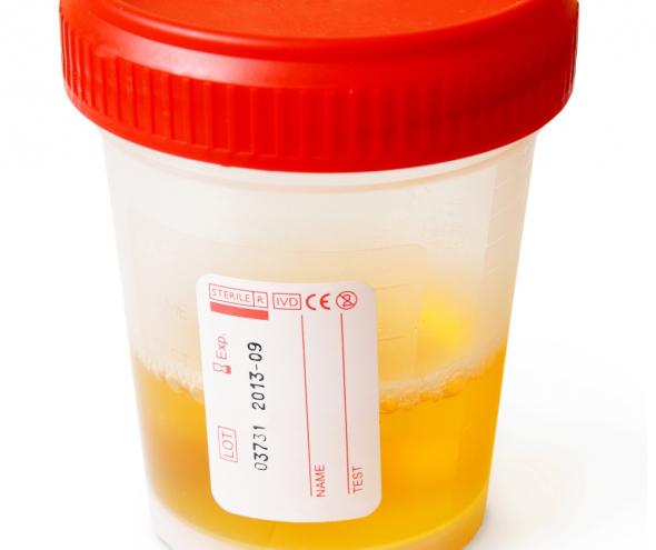 Kolor moczu wskazuje na poziom nawodnienia w organizmie