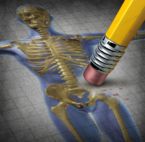 Bieganie może zapobiegać osteoporozie