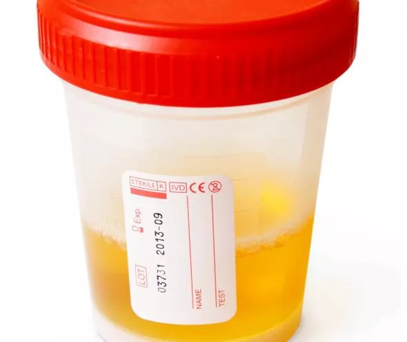 Kolor moczu wskazuje na poziom nawodnienia w organizmie Kolor moczu wskazuje na poziom nawodnienia w organizmie